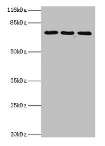 Western blot  | All lanes: ZNF699 antibody at 2µg/ml  | Lane 1: Jurkat whole cell lysate  | Lane 2: K562 whole cell lysate  | Lane 3: U87 whole cell lysate  | Secondary  | Goat polyclonal to rabbit IgG at 1/10000 dilution  | Predicted band size: 74 kDa  | Observed band size: 74 kDaRabbit anti-Human ZNF699 Polyclonal Antibody