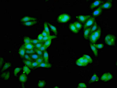 Immunofluorescence staining of HepG2 cells with ZNF703 Antibody at 1:133, counter-stained with DAPI. The cells were fixed in 4% formaldehyde, permeabilized using 0.2% Triton X-100 and blocked in 10% normal Goat Serum. The cells were then incubated with the antibody overnight at 4°C. The secondary antibody was Alexa Fluor 488-congugated AffiniPure Goat Anti-Rabbit IgG(H+L).
