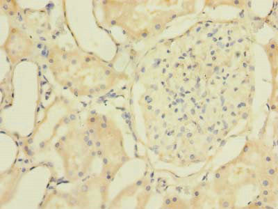 Immunohistochemistry of paraffin-embedded human kidney tissue using the antibody at dilution of 1:100Rabbit anti-Human ZNF707 Polyclonal Antibody