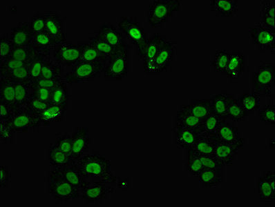 Immunofluorescent analysis of HepG2 cells using FUS Antibody at dilution of 1:100 and Alexa Fluor 488-congugated AffiniPure Goat Anti-Rabbit IgG(H+L)Rabbit anti-Human FUS Polyclonal Antibody
