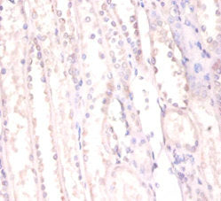 Immunohistochemistry of paraffin-embedded human kidney tissue using FUS Antibody at dilution of 1:100Rabbit anti-Human FUS Polyclonal Antibody