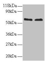 Western blot  | All lanes: FUS antibody at 2µg/ml  | Lane 1: 293T whole cell lysate  | Lane 2: EC109 whole cell lysate  | Secondary  | Goat polyclonal to rabbit IgG at 1/15000 dilution  | Predicted band size: 54 kDa  | Observed band size: 60 kDaRabbit anti-Human FUS Polyclonal Antibody