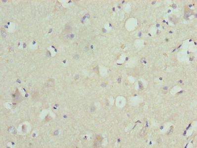 Immunohistochemistry of paraffin-embedded human brain tissue using ZNF821 Antibody at dilution of 1:100Rabbit anti-Human ZNF821 Polyclonal Antibody