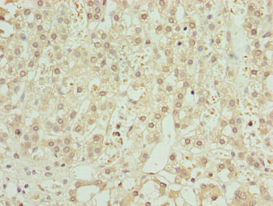 Immunohistochemistry of paraffin-embedded human adrenal gland tissue using ZNF821 Antibody at dilution of 1:100Rabbit anti-Human ZNF821 Polyclonal Antibody