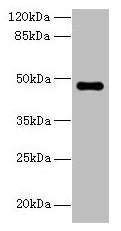 Western blot  | All lanes: ZNF821 antibody at 8µg/ml + MCF-7 whole cell lysate  | Secondary  | Goat polyclonal to rabbit IgG at 1/10000 dilution  | Predicted band size: 47, 43 kDa  | Observed band size: 47 kDaRabbit anti-Human ZNF821 Polyclonal Antibody