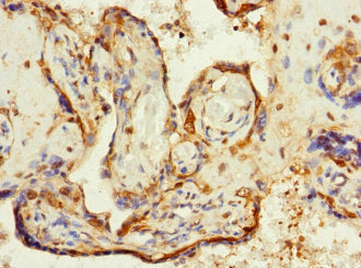 Immunohistochemistry of paraffin-embedded human placenta tissue using ZP2 Antibody at dilution of 1:100Rabbit anti-Human ZP2 Polyclonal Antibody