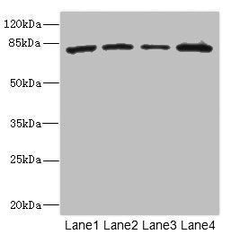 Western blot | All lanes: ZP2 antibody at 3.06μg/ml | Lane 1: 293T whole cell lysate | Lane 2: Hela whole cell lysate | Lane 3: Jurkat whole cell lysate | Lane 4: HepG2 whole cell lysate | Secondary | Goat polyclonal to rabbit IgG at 1/10000 dilution | Predicted band size: 83, 82 kDa | Observed band size: 83 kDaRabbit anti-Human ZP2 Polyclonal Antibody