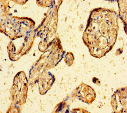 Immunohistochemistry of paraffin-embedded human placenta tissue using ZBED1 Antibody at dilution of 1:100Rabbit anti-Human ZBED1 Polyclonal Antibody