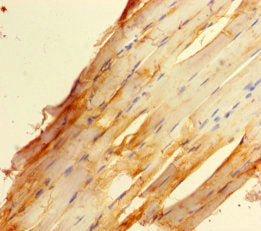 Immunohistochemistry of paraffin-embedded human skeletal muscle tissue using ZBED1 Antibody at dilution of 1:100Rabbit anti-Human ZBED1 Polyclonal Antibody