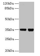 Western blot  | All lanes: ZBED1 antibody at 2µg/ml  | Lane 1: EC109 whole cell lysate  | Lane 2: 293T whole cell lysate  | Secondary  | Goat polyclonal to rabbit IgG at 1/15000 dilution  | Predicted band size: 79 kDa  | Observed band size: 35 kDaRabbit anti-Human ZBED1 Polyclonal Antibody