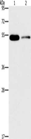 Gel: 8%SDS-PAGE, Lysate: 40 μg, Lane 1-2: Human placenta tissue, human normal liver tissue, Primary antibody: FOXF2 Antibody(FOXF2 Antibody) at dilution 1/666, Secondary antibody: Goat anti rabbit IgG at 1/8000 dilution, Exposure time: 5 minutesRabbit anti-Human FOXF2 Polyclonal Antibody