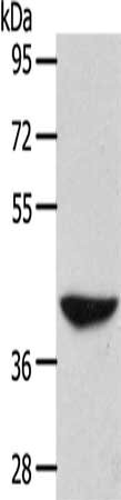 Gel: 10%SDS-PAGE, Lysate: 40 μg, Lane: 293T cells, Primary antibody: ADH1B Antibody(ADH1B Antibody) at dilution 1/450, Secondary antibody: Goat anti rabbit IgG at 1/8000 dilution, Exposure time: 10 minutes