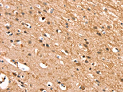 The image on the left is immunohistochemistry of paraffin-embedded Human brain tissue using the antibody Antibody) at dilution 1/30, on the right is treated with synthetic peptide. (Original magnification: ×200)Rabbit anti-Human CSTB Polyclonal Antibody
