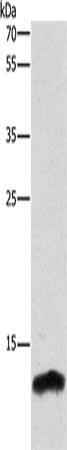 Gel: 10+12%SDS-PAGE, Lysate: 40 μg, Lane: Mouse spleen tissue, Primary antibody: CSTB Antibody(CSTB Antibody) at dilution 1/300, Secondary antibody: Goat anti rabbit IgG at 1/8000 dilution, Exposure time: 2.5 minutesRabbit anti-Human CSTB Polyclonal Antibody