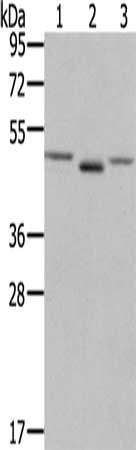 Gel: 6%SDS-PAGE, Lysate: 40 μg, Lane 1-3: NIH/3T3 cells, human placenta tissue, lovo cells, Primary antibody: FGFRL1 Antibody(FGFRL1 Antibody) at dilution 1/400, Secondary antibody: Goat anti rabbit IgG at 1/8000 dilution, Exposure time: 1 minuteRabbit anti-Human FGFRL1 Polyclonal Antibody
