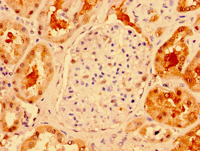 IHC image of TXN Antibody diluted at 1:300 and staining in paraffin-embedded human kidney tissue performed on a Leica BondTM system. After dewaxing and hydration, antigen retrieval was mediated by high pressure in a citrate buffer (pH 6.0). Section was blocked with 10% normal goat serum 30min at RT. Then primary antibody (1% BSA) was incubated at 4°C overnight. The primary is detected by a biotinylated secondary antibody and visualized using an HRP conjugated SP system.Rabbit anti-Human TXN Polyclonal Antibody