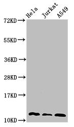 Western Blot  | Positive WB detected in: Hela whole cell lysate, Jurkat whole cell lysate, A549 whole cell lysate  | All lanes: TXN antibody at 3µg/ml  | Secondary  | Goat polyclonal to rabbit IgG at 1/50000 dilution  | Predicted band size: 12, 10 kDa  | Observed band size: 12 kDaRabbit anti-Human TXN Polyclonal Antibody