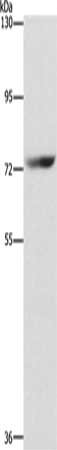 Gel: 6%SDS-PAGE, Lysate: 40 μg, Lane: HepG2 cells, Primary antibody: SENP1 Antibody(SENP1 Antibody) at dilution 1/1500, Secondary antibody: Goat anti rabbit IgG at 1/8000 dilution, Exposure time: 1 secondRabbit anti-Human SENP1 Polyclonal Antibody
