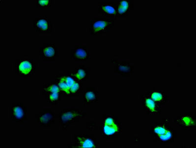 Immunofluorescent analysis of 293T cells using SOD1 Antibody at dilution of 1:100 and Alexa Fluor 488-congugated AffiniPure Goat Anti-Rabbit IgG(H+L)Rabbit anti-Human SOD1 Polyclonal Antibody