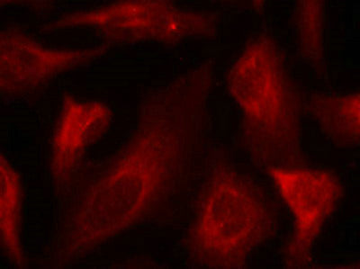 Immunofluorescence staining of methanol-fixed Hela cells using p53(Phospho-Ser33) Antibody.Rabbit anti-Human TP53 Polyclonal Antibody