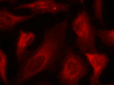 Immunofluorescence staining of methanol-fixed Hela cells using p53(Phospho-Ser33) Antibody.Rabbit anti-Human TP53 Polyclonal Antibody