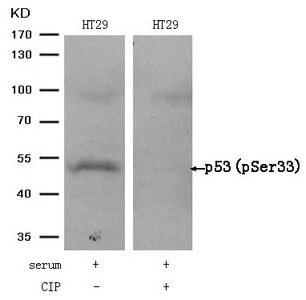 Western blot analysis of extracts from HT29 cells, treated with serum or calf intestinal phosphatase (CIP), using p53 (Phospho-Ser33) Antibody.Rabbit anti-Human TP53 Polyclonal Antibody