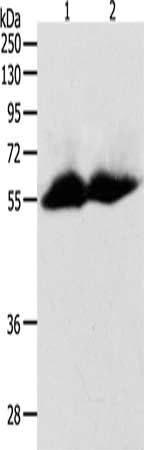 Gel: 10%SDS-PAGE, Lysate: 60 μg, Lane 1-2: Human colon tissue, Human ovarian cancer tissue, Primary antibody: MMP11 Antibody(MMP11 Antibody) at dilution 1/600, Secondary antibody: Goat anti rabbit IgG at 1/8000 dilution, Exposure time: 1 minute