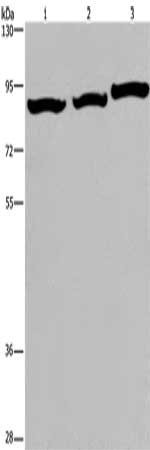 Gel: 6%SDS-PAGE, Lysate: 40 μg, Lane 1-3: A172 cells, mouse brain tissue, NIH/3T3 cells, Primary antibody: MAPT Antibody(MAPT Antibody) at dilution 1/740, Secondary antibody: Goat anti rabbit IgG at 1/8000 dilution, Exposure time: 30 seconds