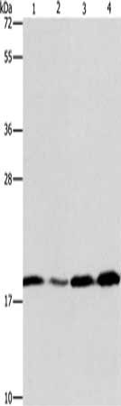 Gel: 10%SDS-PAGE, Lysate: 40 μg, Lane 1-4: A431 cells, human liver cancer tissue, 231 cells, human fetal liver tissue, Primary antibody: ARF6 Antibody(ARF6 Antibody) at dilution 1/200, Secondary antibody: Goat anti rabbit IgG at 1/8000 dilution, Exposure time: 20 secondsRabbit anti-Human ARF6 Polyclonal Antibody