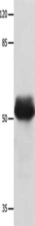 Gel: 8%SDS-PAGE, Lysate: 40 μg, Lane: Hela cells, Primary antibody: MUTYH Antibody(MUTYH Antibody) at dilution 1/500, Secondary antibody: Goat anti rabbit IgG at 1/8000 dilution, Exposure time: 1 minuteRabbit anti-Human MUTYH Polyclonal Antibody