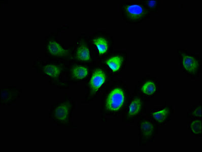 Immunofluorescence staining of A549 cells with the antibody at 1:166, counter-stained with DAPI. The cells were fixed in 4% formaldehyde, permeabilized using 0.2% Triton X-100 and blocked in 10% normal Goat Serum. The cells were then incubated with the antibody overnight at 4°C. The secondary antibody was Alexa Fluor 488-congugated AffiniPure Goat Anti-Rabbit IgG(H+L).Rabbit anti-Human PRMT1 Polyclonal Antibody