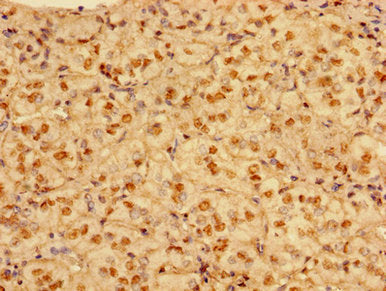 Immunohistochemistry of paraffin-embedded human adrenal gland tissue using PRMT1 Antibody at dilution of 1:100Rabbit anti-Human PRMT1 Polyclonal Antibody