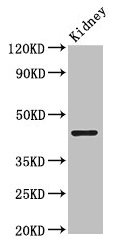 Western Blot  | Positive WB detected in: Mouse kidney tissue  | All lanes: PRMT1 antibody at 2.5µg/ml  | Secondary  | Goat polyclonal to rabbit IgG at 1/50000 dilution  | Predicted band size: 43, 40, 41, 33 kDa  | Observed band size: 43 kDaRabbit anti-Human PRMT1 Polyclonal Antibody