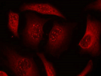 Immunofluorescence staining of methanol-fixed HeLa cells using FKHRL1 (phospho-Ser253) antibody.Rabbit anti-Human FOXO3 Polyclonal Antibody