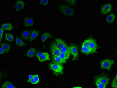 Immunofluorescent analysis of MCF-7 cells using GOT2 Antibody at dilution of 1:100 and Alexa Fluor 488-congugated AffiniPure Goat Anti-Rabbit IgG(H+L)Rabbit anti-Human GOT2 Polyclonal Antibody