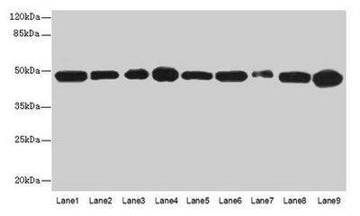 Western blot  | All lanes: GOT2 antibody at 3µg/ml  | Lane 1: A431 whole cell lysate  | Lane 2: HepG2 whole cell lysate  | Lane 3: Mouse muscle tissue   | Lane 4: Mouse spleen tissue  | Lane 5: MCF-7 whole cell lysate  | Lane 6: Hela whole cell lysate  | Lane 7: LO2 whole cell lysate  | Lane 8: 293T whole cell lysate  | Lane 9: HL60 whole cell lysate  | Secondary  | Goat polyclonal to rabbit IgG at 1/10000 dilution  | Predicted band size: 48, 44 kDa  | Observed band size: 48 kDaRabbit anti-Human GOT2 Polyclonal Antibody