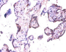 Immunohistochemistry of paraffin-embedded human placenta tissue using EXTL3 Antibody at dilution of 1:100Rabbit anti-Human EXTL3 Polyclonal Antibody