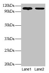 Western blot  | All lanes: EXTL3 antibody at 2µg/ml  | Lane 1: EC109 whole cell lysate  | Lane 2: 293T whole cell lysate  | Secondary  | Goat polyclonal to rabbit IgG at 1/15000 dilution  | Predicted bane side: 105 kDa  | Observed band side: 105 kDaRabbit anti-Human EXTL3 Polyclonal Antibody