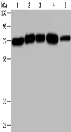 Gel: 8%SDS-PAGE, Lysate: 40 μg, Lane 1-5: A172 cells, Hela cells, 293T cells, K562 cells, human testis tissue, Primary antibody: AGFG1 Antibody(AGFG1 Antibody) at dilution 1/533, Secondary antibody: Goat anti rabbit IgG at 1/8000 dilution, Exposure time: 40 secondsRabbit anti-Human AGFG1 Polyclonal Antibody