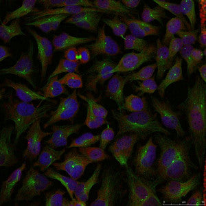 Immunofluorescence staining of methanol-fixed Hela cells using Stathmin 1(Ab-25) Antibody.Rabbit anti-Human STMN1 Polyclonal Antibody