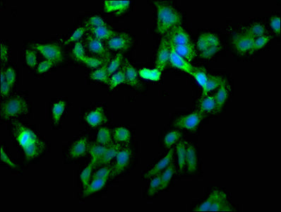 Immunofluorescence staining of HepG2 cells with EIF3G Antibody at 1:133, counter-stained with DAPI. The cells were fixed in 4% formaldehyde, permeabilized using 0.2% Triton X-100 and blocked in 10% normal Goat Serum. The cells were then incubated with the antibody overnight at 4°C. The secondary antibody was Alexa Fluor 488-congugated AffiniPure Goat Anti-Rabbit IgG(H+L).Rabbit anti-Human EIF3G Polyclonal Antibody