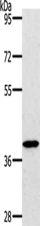 Gel: 10%SDS-PAGE, Lysate: 50 μg, Lane: Jurkat cells, Primary antibody: BDKRB2 Antibody(BDKRB2 Antibody) at dilution 1/800, Secondary antibody: Goat anti rabbit IgG at 1/8000 dilution, Exposure time: 1 minute
