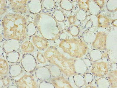Immunohistochemistry of paraffin-embedded human kidney tissue using TBCB Antibody at dilution of 1:100Rabbit anti-Human TBCB Polyclonal Antibody
