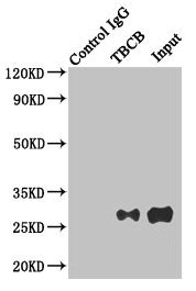 Immunoprecipitating TBCB in Hela whole cell lysate  | Lane 1: Rabbit control IgG instead of (1µg) instead of TBCB Antibody in Hela whole cell lysate. For western blotting, a HRP-conjugated anti-rabbit IgG, specific to the non-reduced form of IgG was used as the Secondary antibody (1/50000)  | Lane 2: TBCB Antibody (4µg) + Hela whole cell lysate (500µg)  | Lane 3: Hela whole cell lysate (20µg)Rabbit anti-Human TBCB Polyclonal Antibody