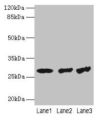 Western blot  | All lanes: TBCB antibody at 4µg/ml  | Lane 1: Hela whole cell lysate  | Lane 2: A549 whole cell lysate  | Lane 3: Jurkat whole cell lysate  | Secondary  | Goat polyclonal to rabbit IgG at 1/10000 dilution  | Predicted band size: 28, 22 kDa  | Observed band size: 28 kDaRabbit anti-Human TBCB Polyclonal Antibody