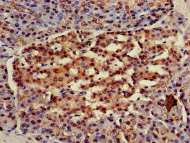 Immunohistochemistry of paraffin-embedded human pancreatic tissue using HSPA8 Antibody at dilution of 1:100Rabbit anti-Human HSPA8 Polyclonal Antibody