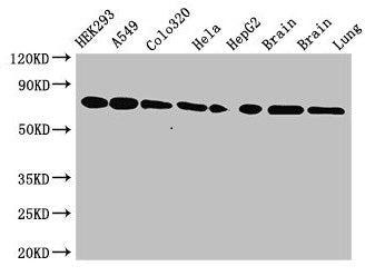 Western Blot  | Positive WB detected in: HEK293 whole cell lysate, A549 whole cell lysate, Colo320 whole cell lysate, Hela whole cell lysate, HepG2 whole cell lysate, Mouse brain tissue, Rat brain tissue, Rat lung tissue  | All lanes: HSPA8 antibody at 3.5µg/ml  | Secondary  | Goat polyclonal to rabbit IgG at 1/50000 dilution  | Predicted band size: 71, 54 kDa  | Observed band size: 71 kDaRabbit anti-Human HSPA8 Polyclonal Antibody