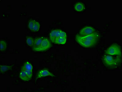 Immunofluorescent analysis of MCF-7 cells using PHGDH Antibody at dilution of 1:100 and Alexa Fluor 488-congugated AffiniPure Goat Anti-Rabbit IgG(H+L)Rabbit anti-Human PHGDH Polyclonal Antibody