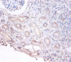 Immunohistochemistry of paraffin-embedded human kidney tissue using PHGDH Antibody at dilution of 1:100Rabbit anti-Human PHGDH Polyclonal Antibody
