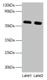 Western blot  | All lanes: PHGDH antibody at 2µg/ml  | Lane 1: EC109 whole cell lysate  | Lane 2: 293T whole cell lysate  | Secondary  | Goat polyclonal to rabbit IgG at 1/15000 dilution  | Predicted band size: 57 kDa  | Observed band size: 57 kDaRabbit anti-Human PHGDH Polyclonal Antibody
